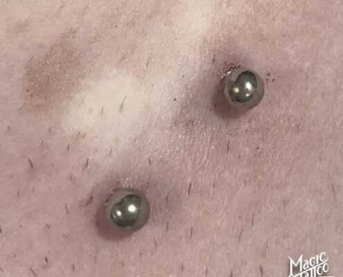 Felszíni piercing
